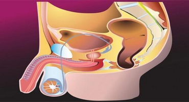 Mod relaxant pentru a preveni adenomul prostatic