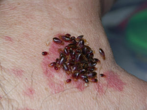 Сонник паразити черви на тілі або під шкірою бачити до чого сняться