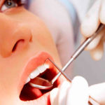 Egalarea dinților în metodele de adulți, preț, ghidul dentar