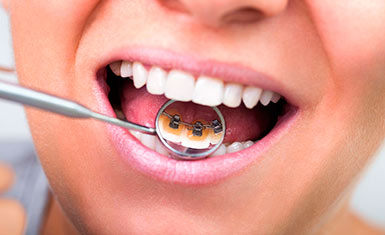 Вирівнювання зубів у дорослих способи, ціна, гід по стоматології