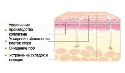 Хімічний пілінг опис, протипоказання, результат