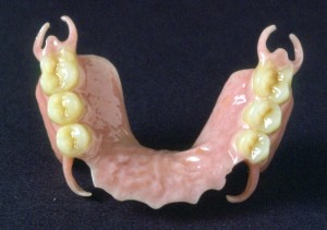 Зубні протези квадротті і їх фото
