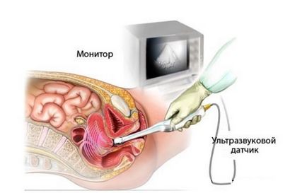 Biometria cervicală ca studiu