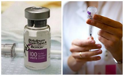 Botox a hónaljban - Botox kezelés hyperhidrosis