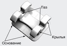 Брекети в Мінську - вартість і фото брекет-систем