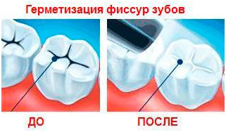 Дитяча стоматологія в киеве - якісні послуги від стоматологічної клініки династія