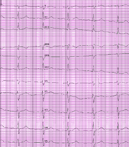 Eq 5