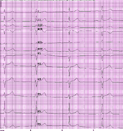 Eq 5