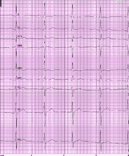 Eq 5