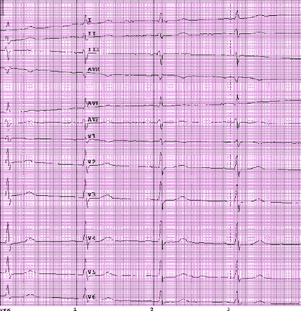 Eq 5