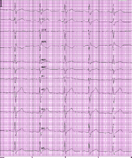 Eq 5