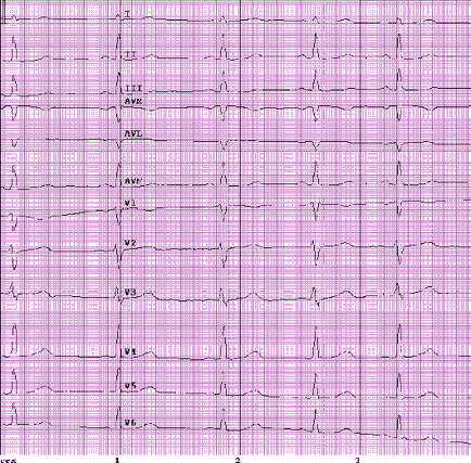 Eq 5