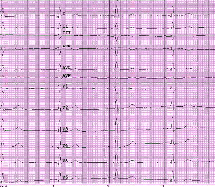 Eq 5