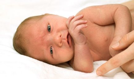 Boala hemolitică a cauzelor nou-născuților, tratament