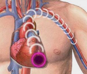 Hygromes pe tratamentul chirurgical al tendonului și reabilitare