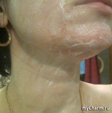 Intenzív maszk a bőr regenerálódását, az arc és a nyak a lehetetlent! )) - nonicare regeneratív