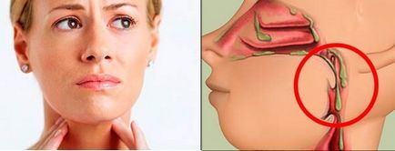 Як позбутися від слизу в носоглотці або горлі - леді блиск! здоров'я інфо