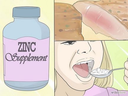 Hogyan lehet megelőzni a hajhullást kezelés során Roaccutane (haj) Hogyan lehet megelőzni a hajhullást kezelés alatt Roaccutane