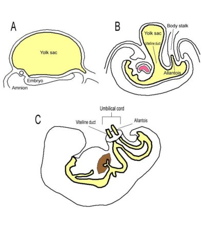 Chistul Urchus și celelalte patologii ale acestuia la clasificarea, cauzele, simptomele, tratamentul bărbaților și femeilor