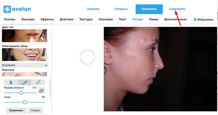 Modelarea computerizată înainte de rinoplastia nasului