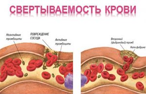 Tratamentul aterosclerozei prin trifoi de luncă