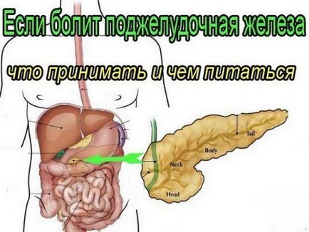 Tratamentul pancreatitei cu remedii folclorice este cel mai eficient, pancreatita