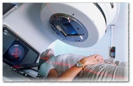 Terapia radiologică efectuată, care sunt consecințele
