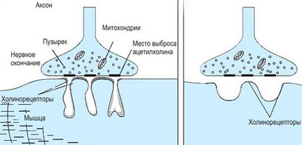 Myasthenia gravis contraindicații majore, nutriție și tratament, efect asupra sarcinii