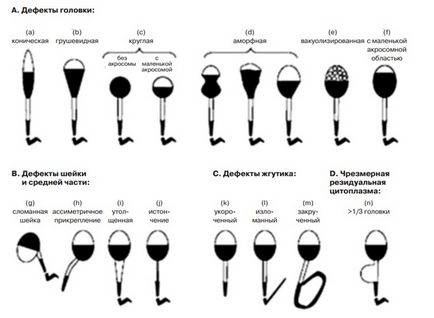 Morfologia spermatozoizilor