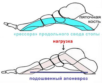 Чи може п'яткова шпора пройти сама і як цьому зарадити