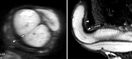 MRI szakértő mri férfi nemi szervek