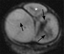 MRI szakértő mri férfi nemi szervek