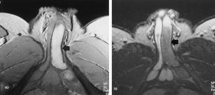 MRI szakértő mri férfi nemi szervek