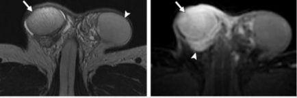 MRI szakértő mri férfi nemi szervek