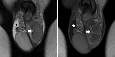 MRI szakértő mri férfi nemi szervek