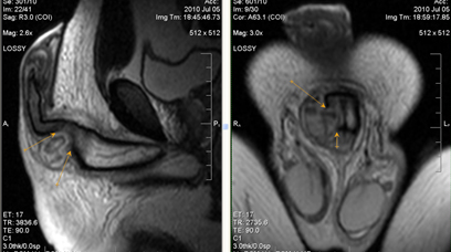 MRI szakértő mri férfi nemi szervek