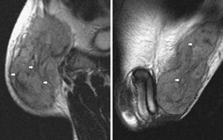 MRI szakértő mri férfi nemi szervek