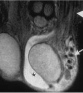 MRI szakértő mri férfi nemi szervek