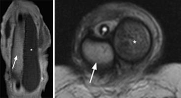 MRI szakértő mri férfi nemi szervek