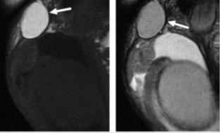 MRI szakértő mri férfi nemi szervek