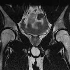 MRI a kismedencei szervek férfiaknál