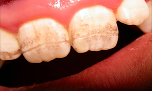 Спадкові стоматологічні захворювання види і симптоми, цілодобова стоматологія в москві