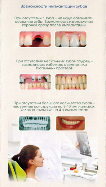 Implantarea dentară ieftină în g