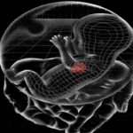 Truncus arteriosus - okai, tünetei és kezelése