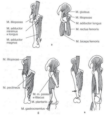 Tratamentul operativ al fracturilor închise ale oaselor tubulare lungi - polytrauma, fracturi de lungă durată