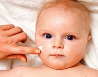 Száj körüli bőrgyulladás, a gyermek és a kezelés gyermekeknél