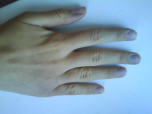 Motivele pentru care unghiile sunt unghiile albastre, albastre pe degetele de la picioare