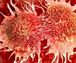 Cancerul se va vindeca, determinând celulele să se împartă mai repede