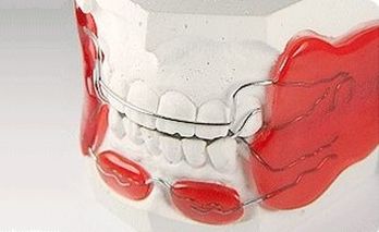 Tratamentul ortodontic timpuriu