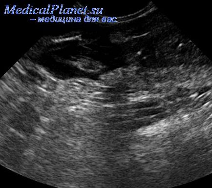 Radiografie a pieptului în organism